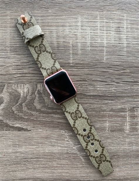 epic fake watches|i phone watch bands.